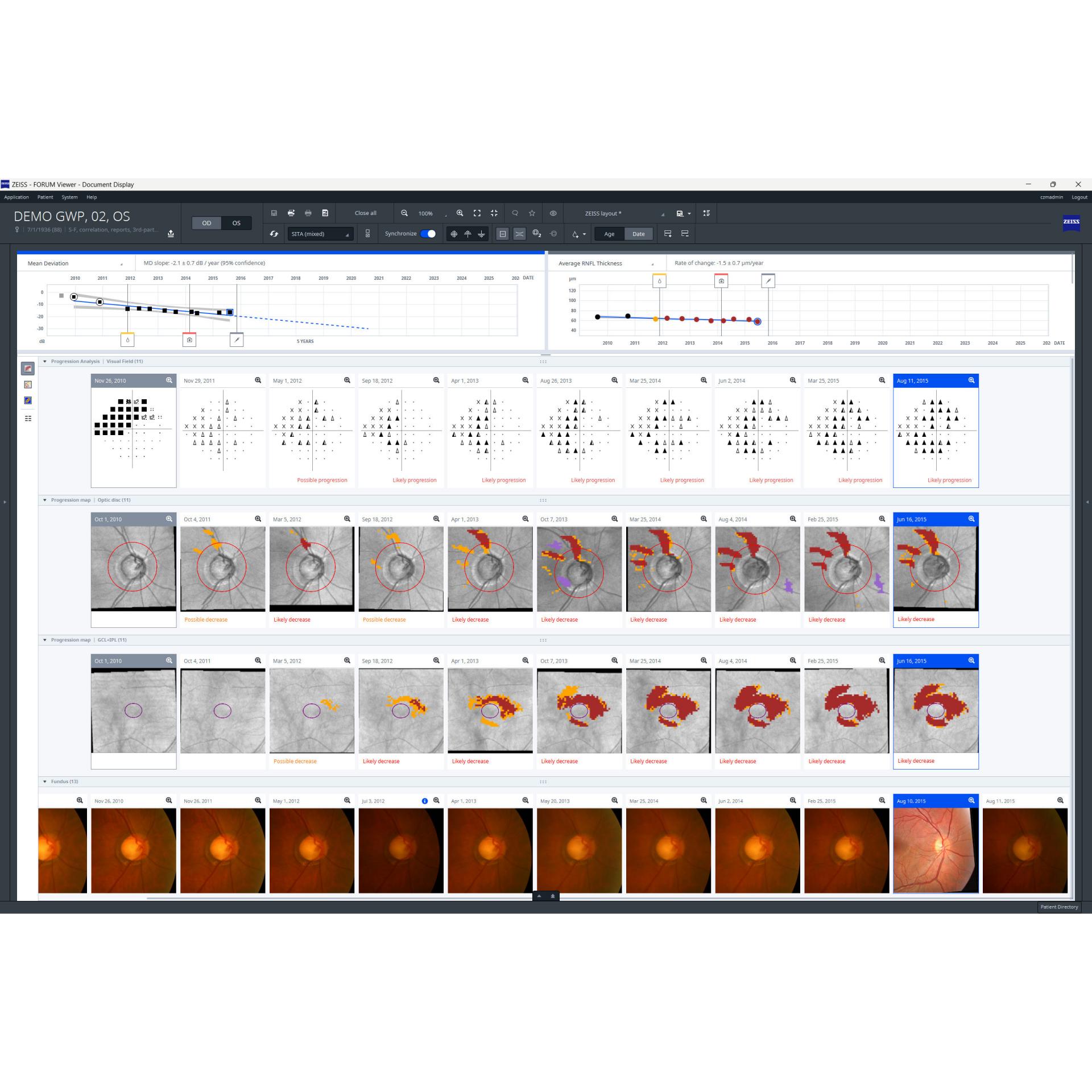 Monitor Zeiss