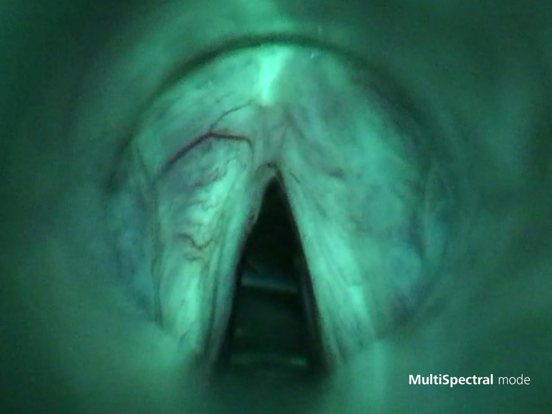 Aplicación de microscopio, modo estándar