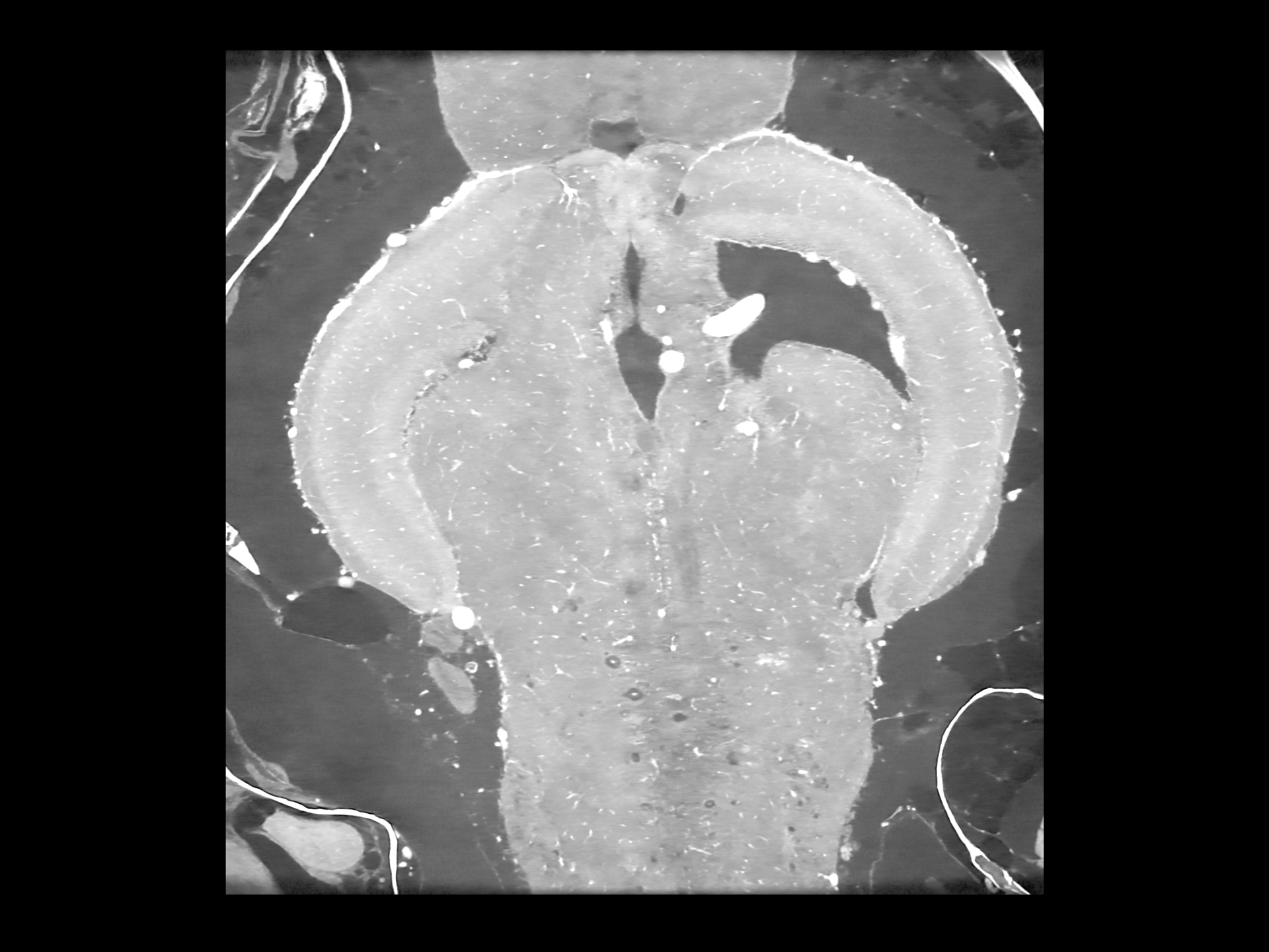 Zebrafish