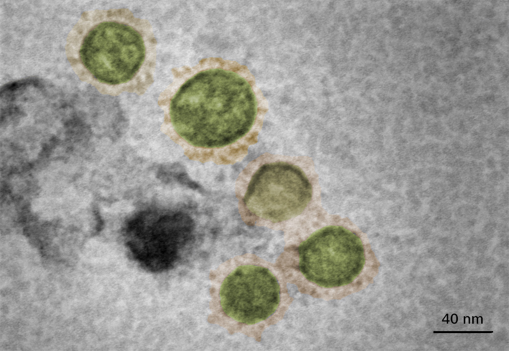 SARS-CoV-2  virus