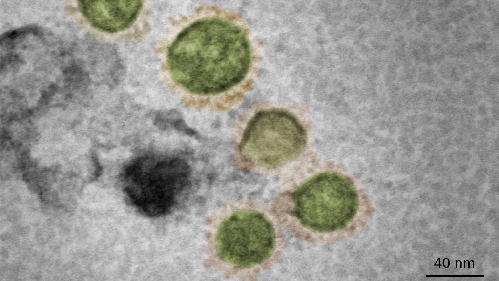 SARS-CoV-2  virus