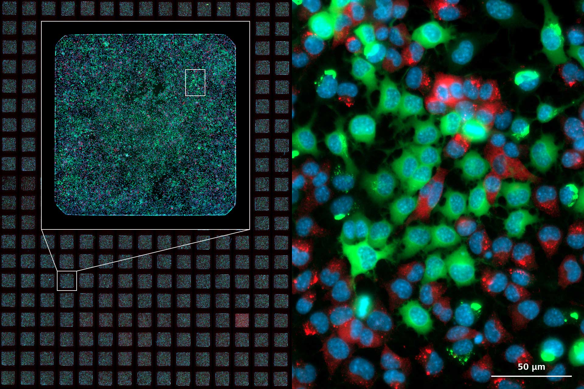 Image d'une plaque de microtitration à 384 cupules réalisée à différents grossissements et selon 3 canaux.