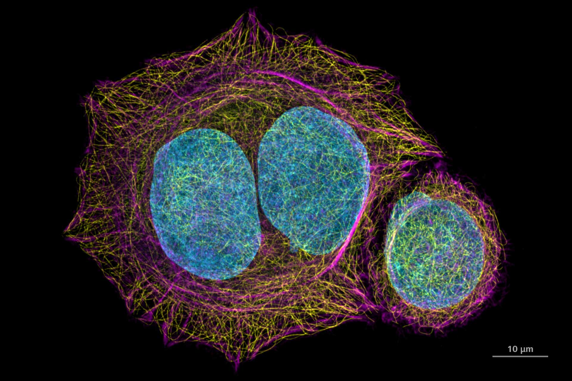 Cellules HeLa colorées pour l'ADN (bleu, Hoechst 44432), microtubules (jaune, anti-tubuline Alexa 488) et la F-actine (magenta, phalloïdine Abberior STAR Red). Imagées avec ZEISS Airyscan 2 en mode Multiplex. 