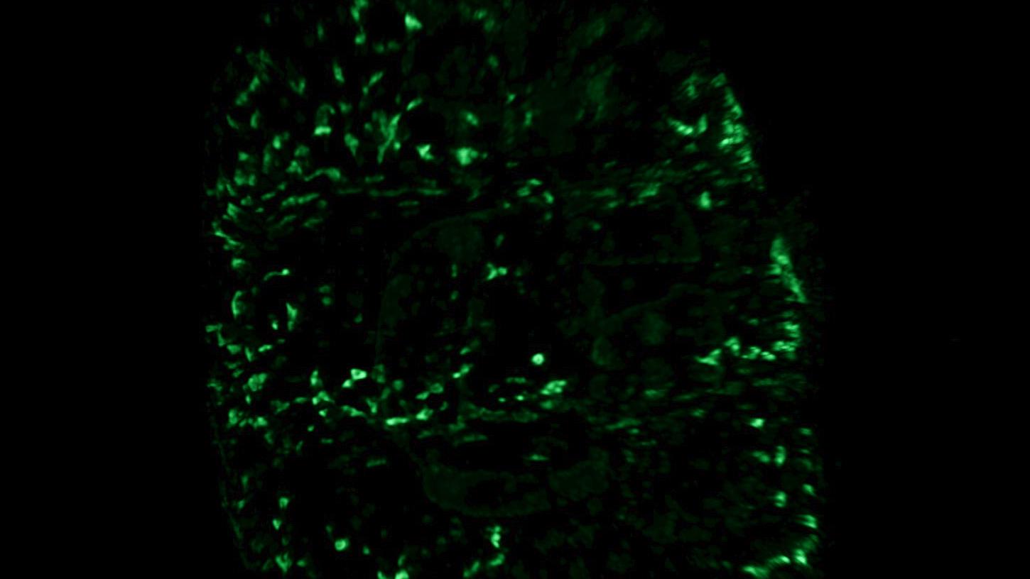 Chrysalide de drosophile en développement