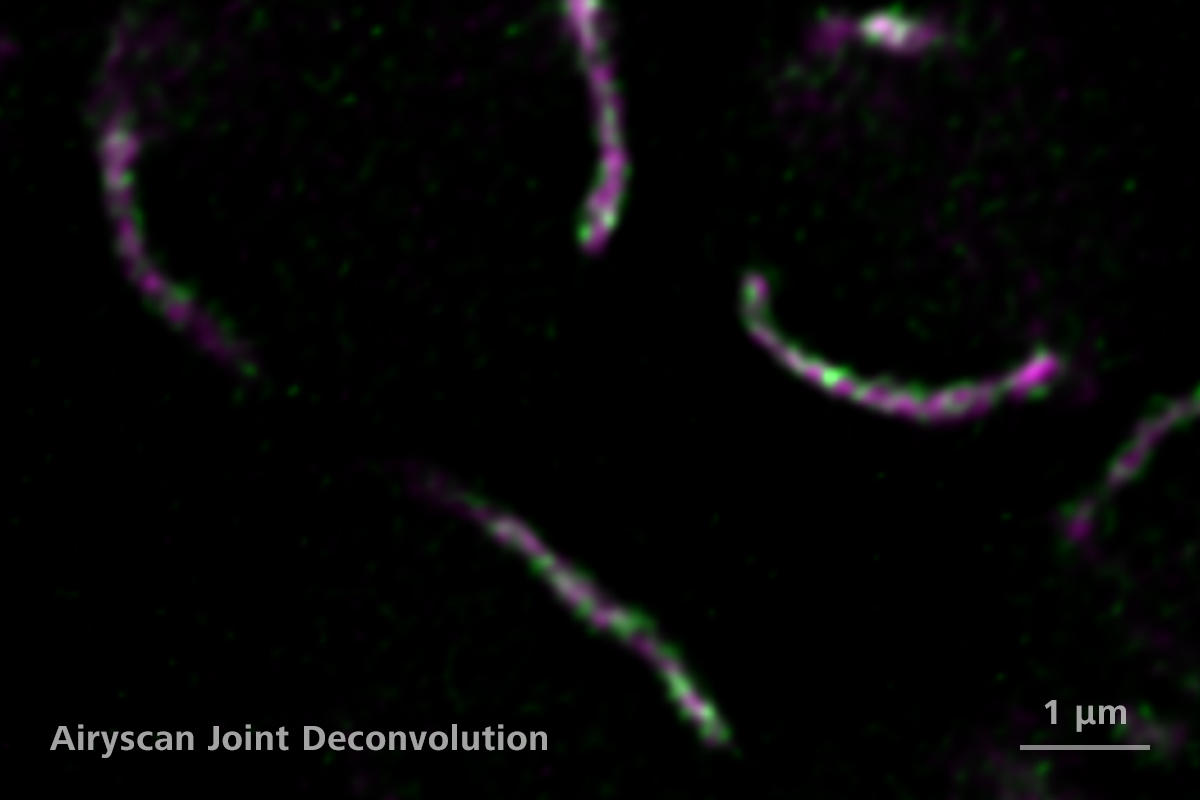 Cellules de levure bourgeonnante avec la protéine localisée à la membrane interne mitochondriale (vert) et à la matrice mitochondriale (magenta). 