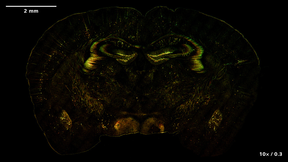 Images SIM² Apotome et Lattice SIM² d'un cerveau murin exprimant le marqueur neuronal Thy1-eGFP. Les images représentent le codage couleur ou les projections d'intensité maximale des données de volume. Échantillon fourni avec l'aimable autorisation de Herms Lab (MCN, Université de Munich, Allemagne)