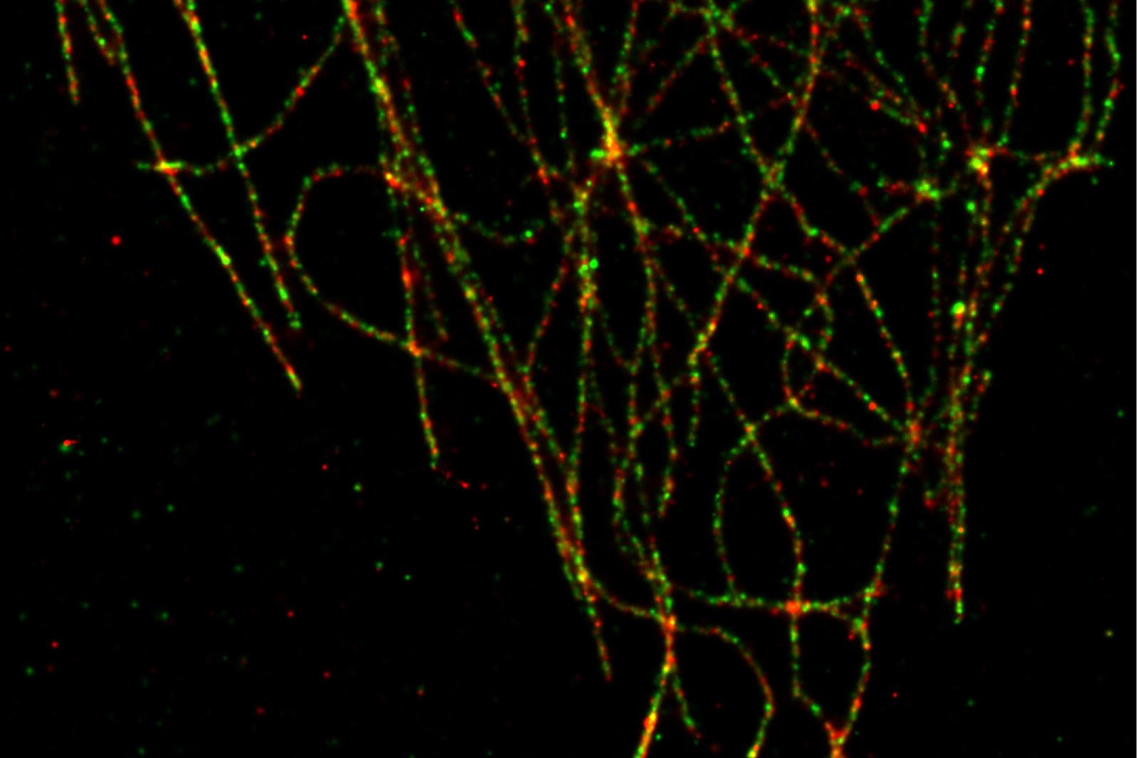 SMLM : L'alpha tubuline a été marquée avec Alexa 555 et la bêta tubuline avec Alexa 488.