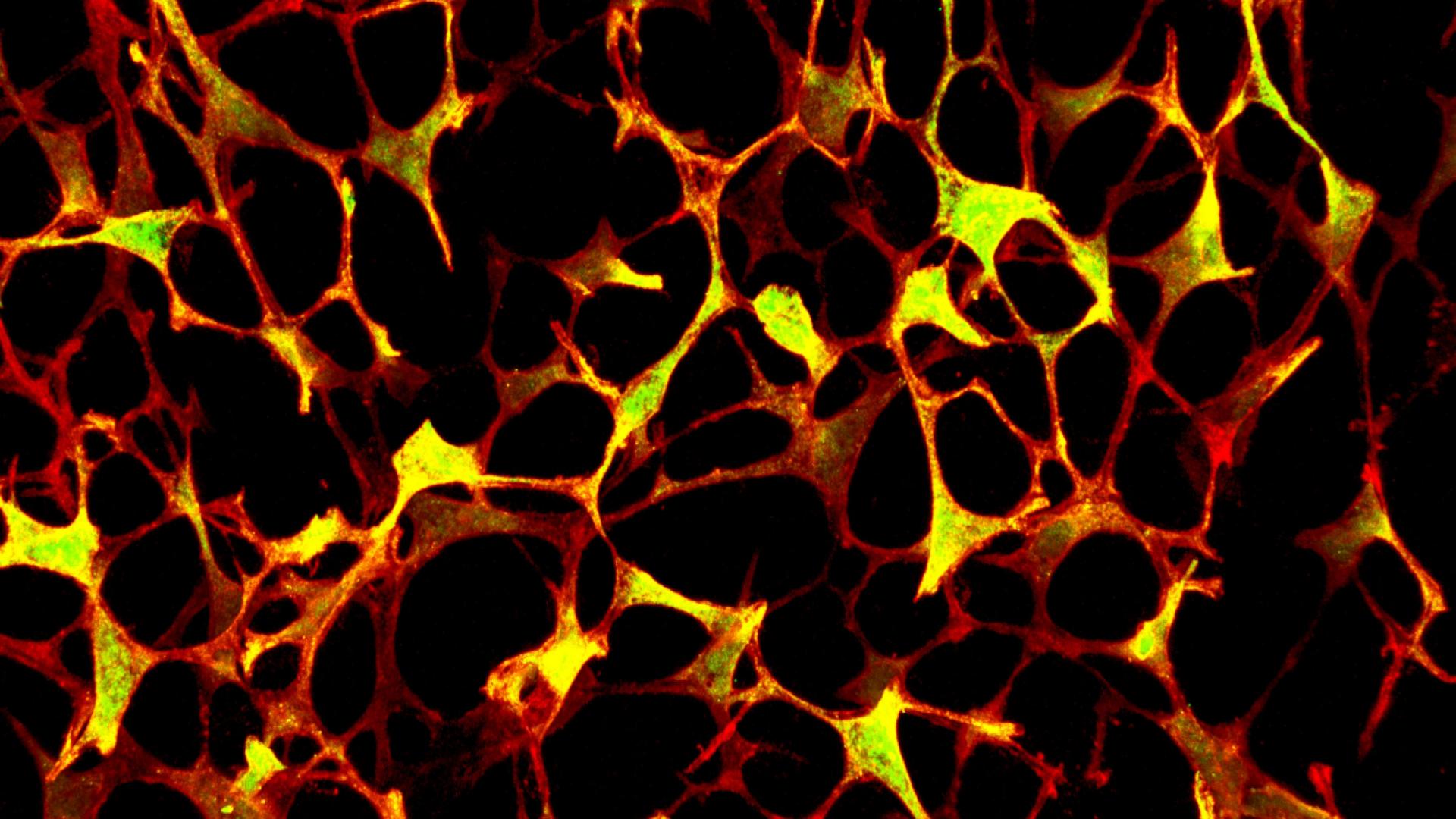 Microscopic image of porous, web-like structure with orange and yellow hues on a black background, resembling a network of interconnected cells or tissue fibers.